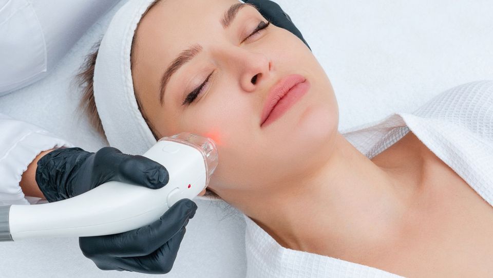 Laser facials near me