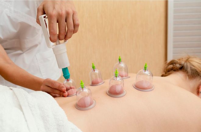 Cupping therapy small