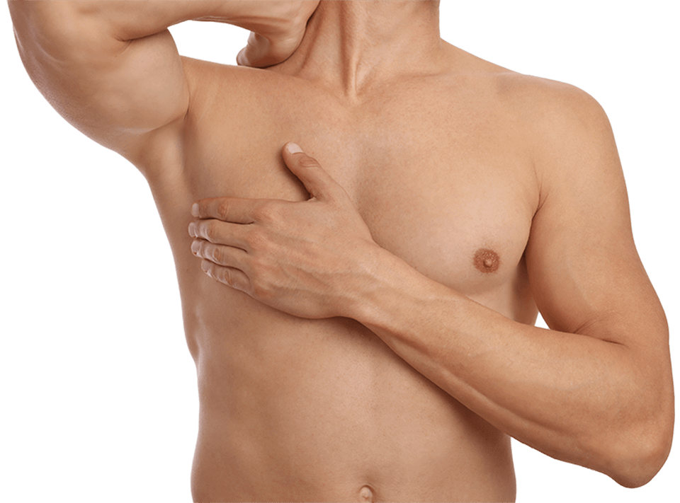 Gynecomastia, Male Breast Reduction