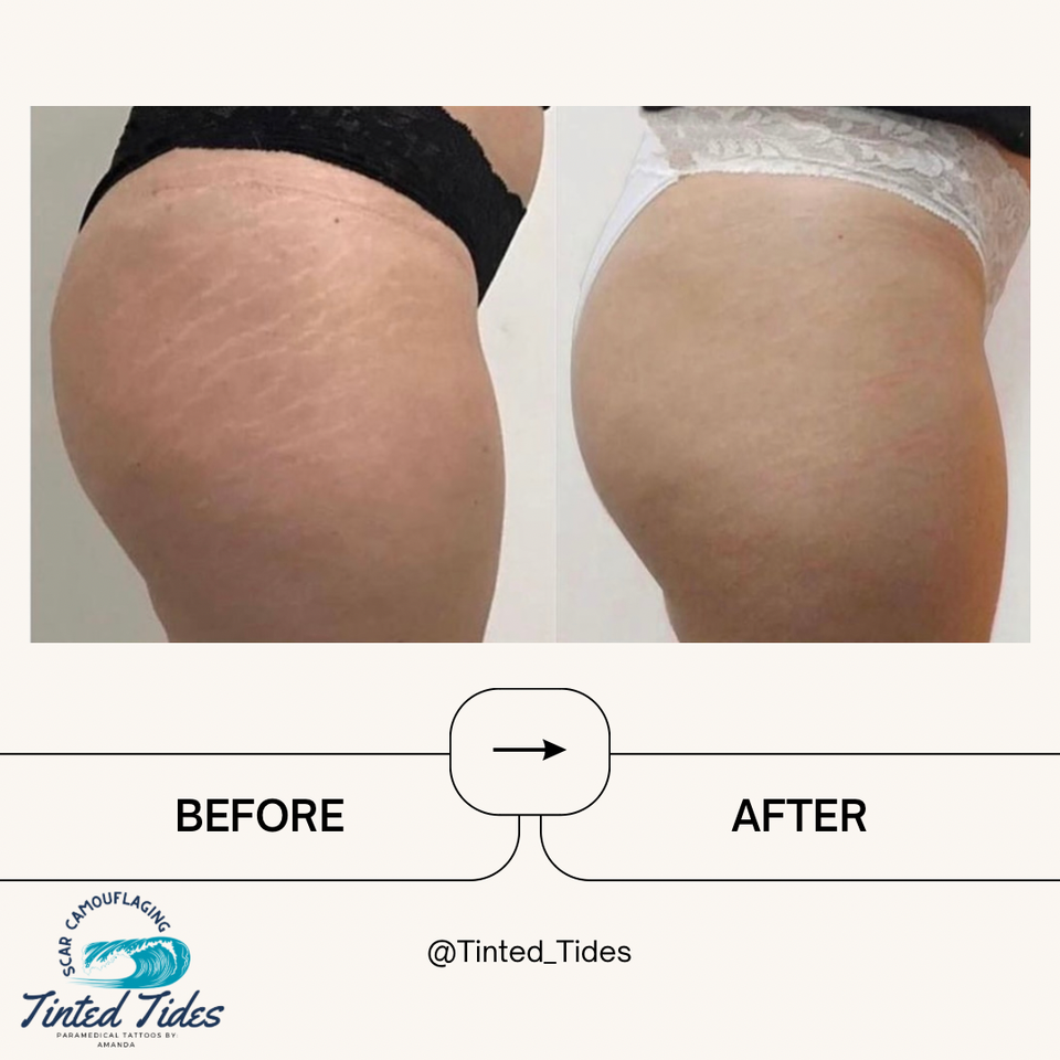 1fddb0f4 abfa 425f b279 34a0e108d758