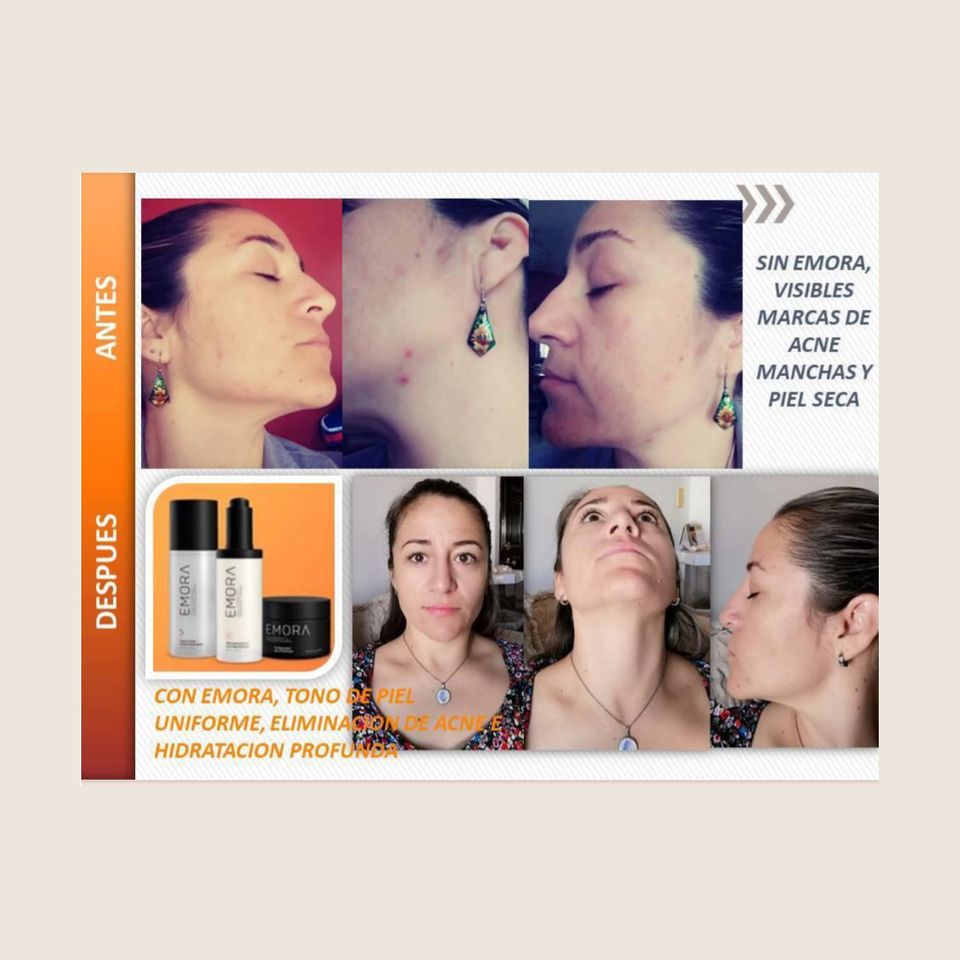 Galery activz4