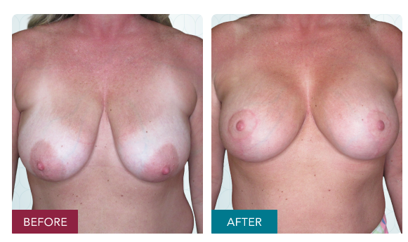 Screenshot 2026 03 13 at 3.17.19 pm