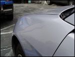 Dentsnomore.com before after 11