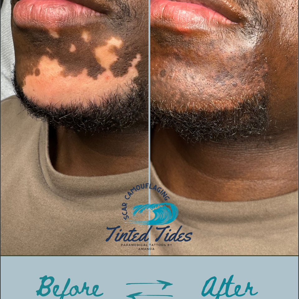 Beige minimalist beauty skincare before after collage instagram post.png