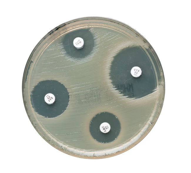 Escherichia coli atcc 35218 on mueller hinton agar plate white background.jpg 650