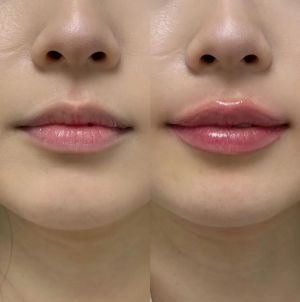 Touch up sessions