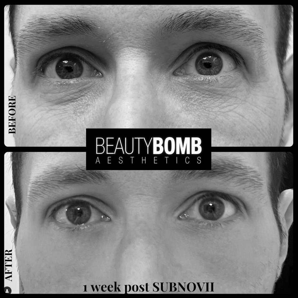 Subnovii beautybomb 01bw