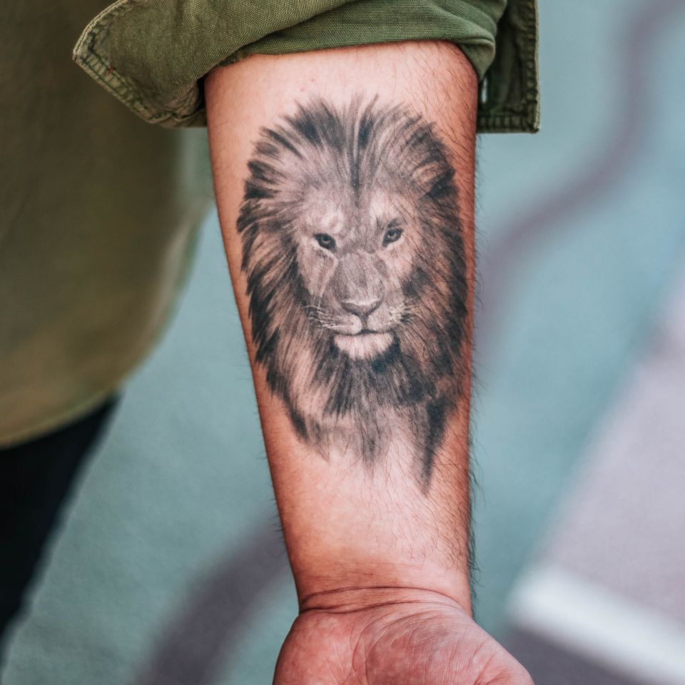Laser Tattoo Removal