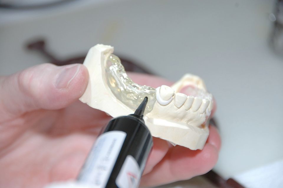 Teethglue