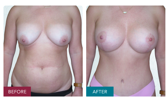 Screenshot 2026 03 13 at 3.42.12 pm