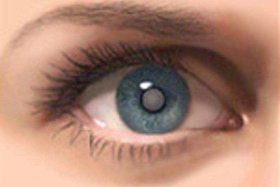 Cataract eye