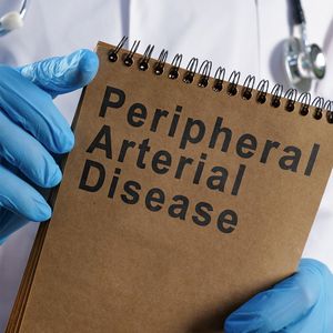 Peripheral srterial disease