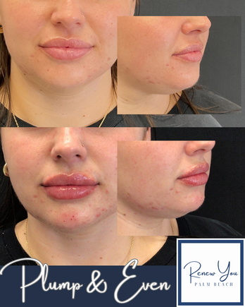 Lips   2
