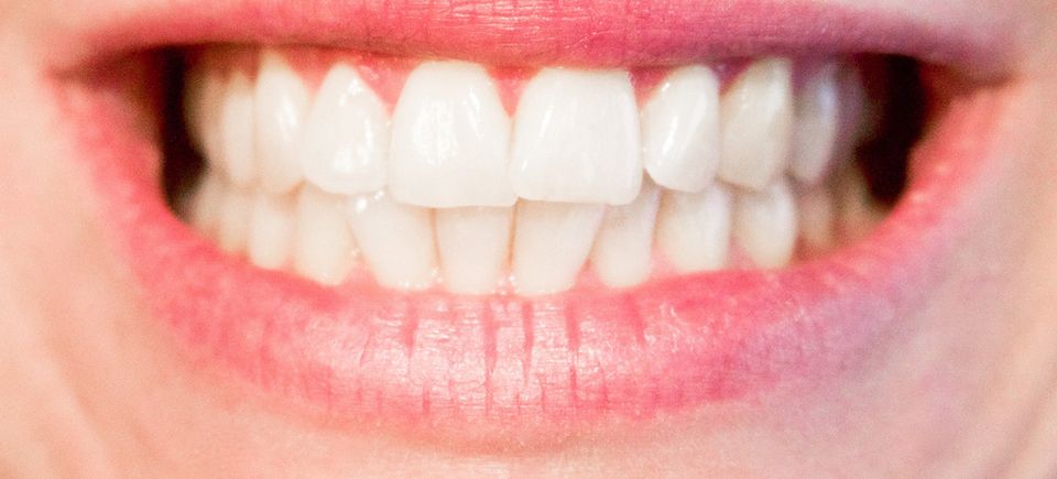 Teeth20170519 2252 77bvuf