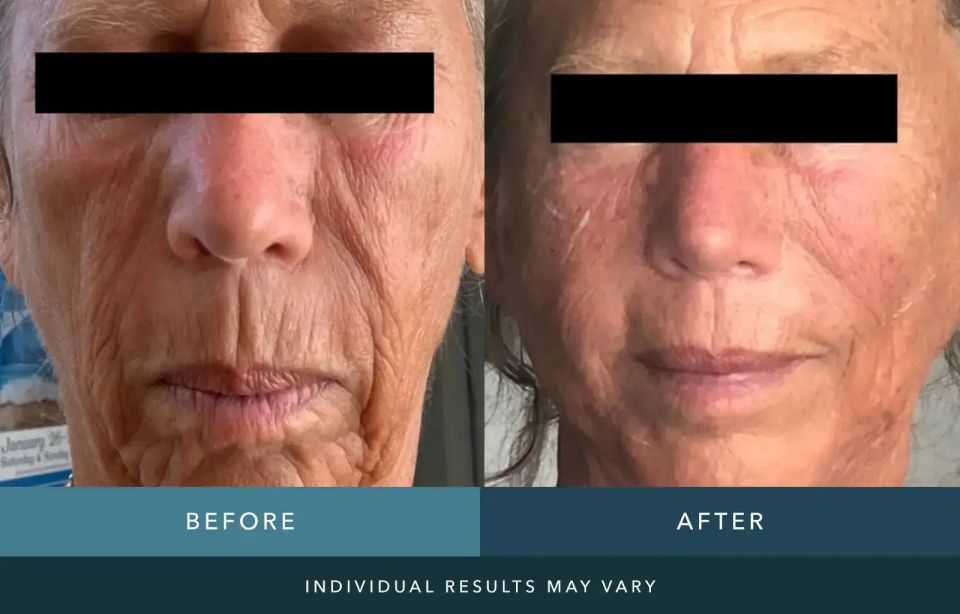 Before and after jpg