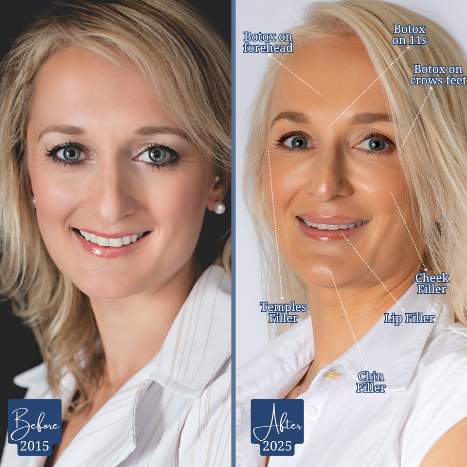 Brianne beforeafter cover2 2