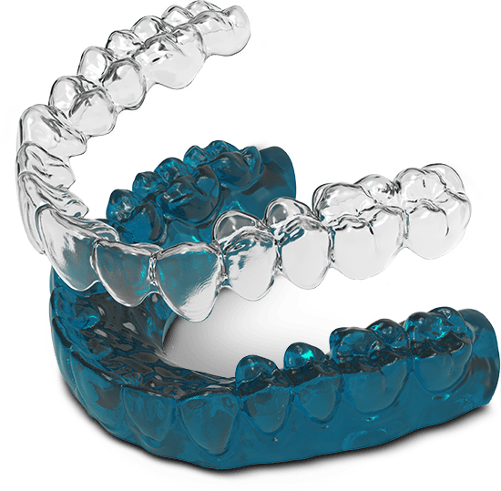 Invisalign model