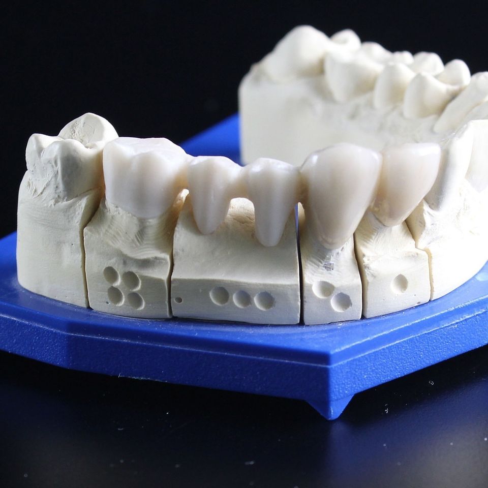Tooth replacement 51e5dc4a48 1920