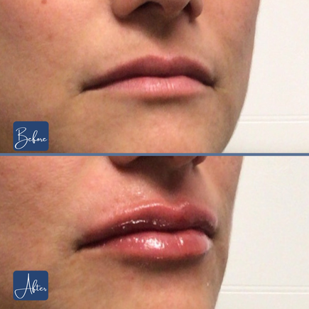Lips 32