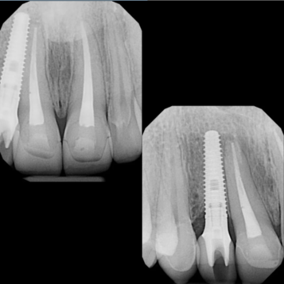 Siteswan   elite dental grp (1)