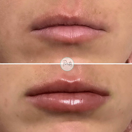 Lips 4