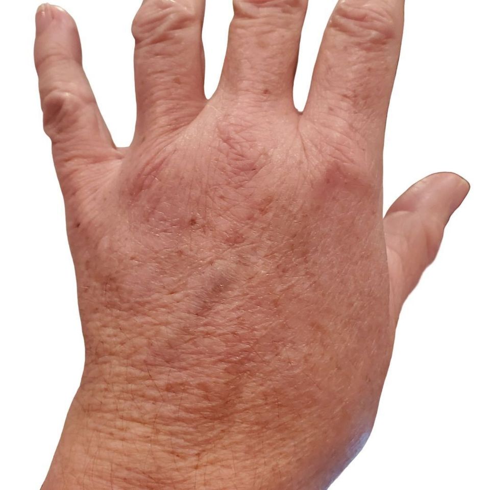 After hand