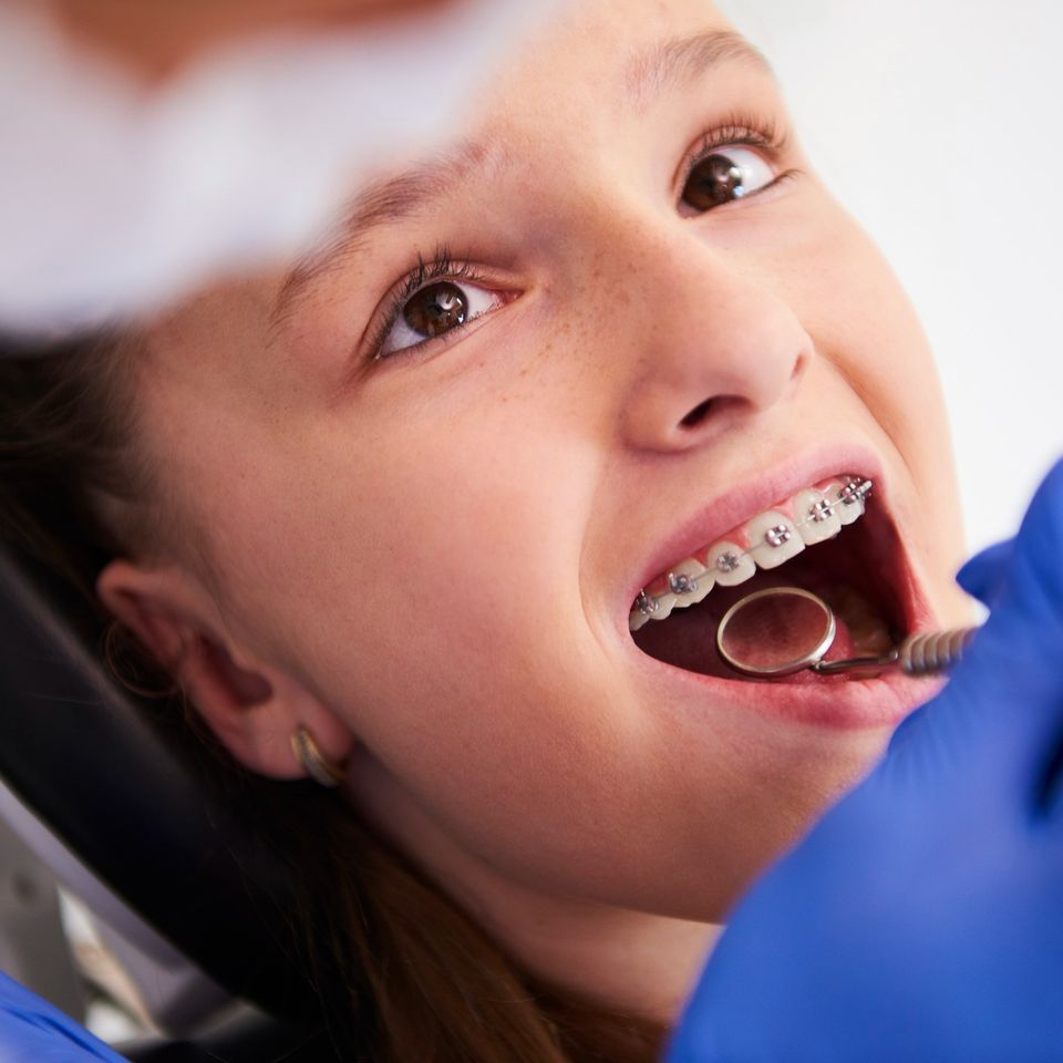 Early Orthodontic services