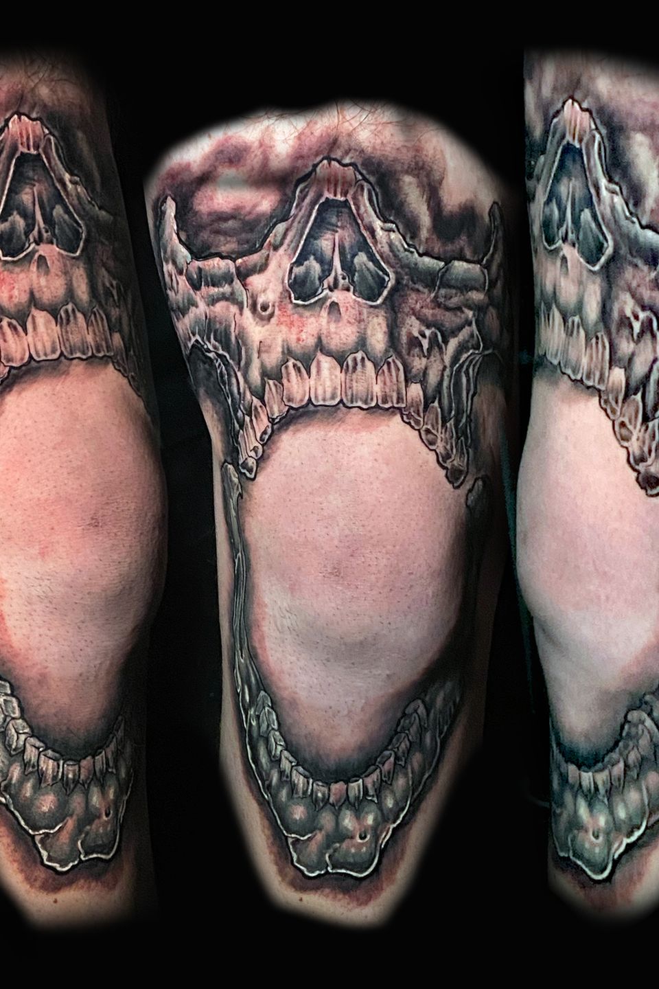 Josh skull on knee
