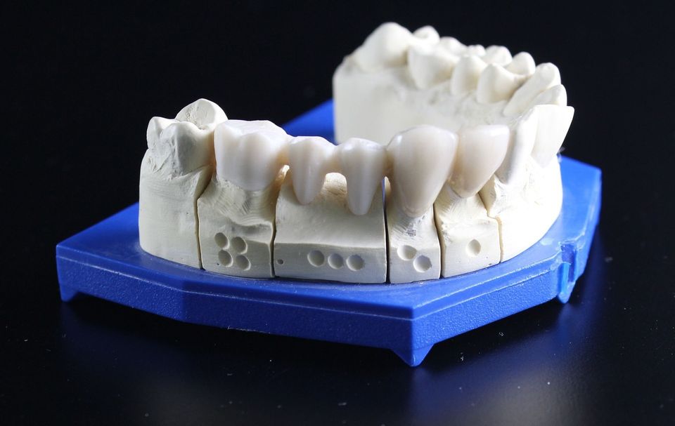 Tooth replacement 51e5dc4a48 1920
