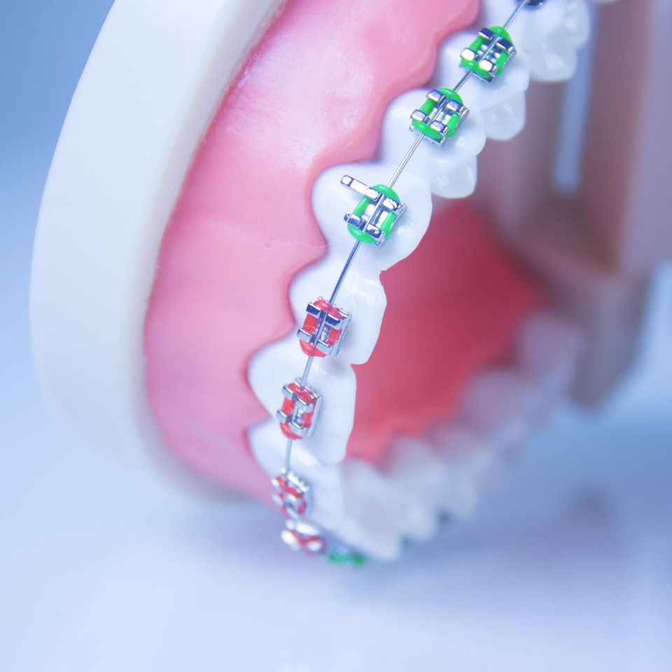 Orthodontic services