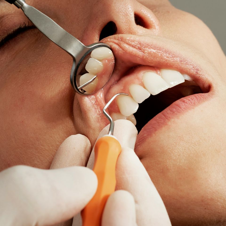 Preventative Dentistry