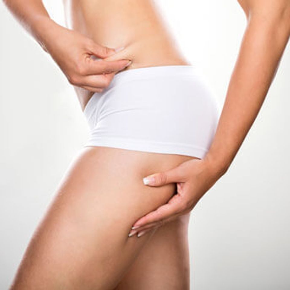 Liposuction