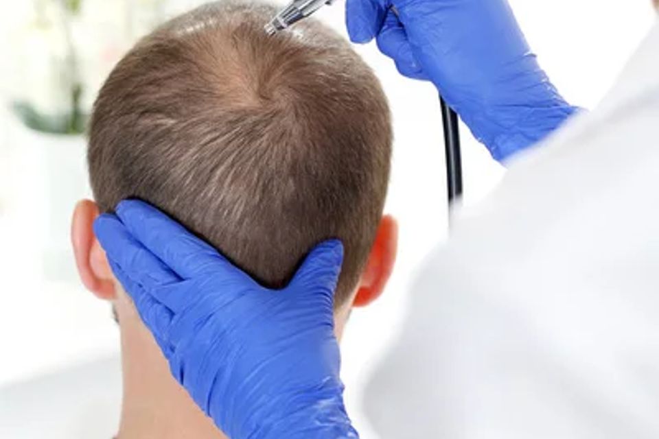 Depositphotos 197440552 stock photo oxygen therapy hair loss head