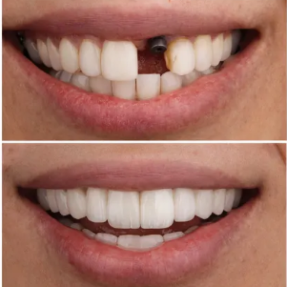 Siteswan   elite dental grp