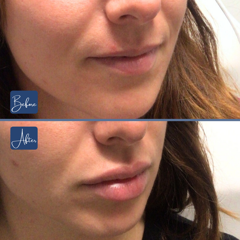 Lips 24