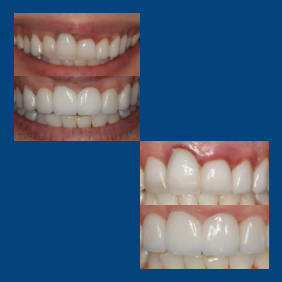 Siteswan   elite dental grp (2)