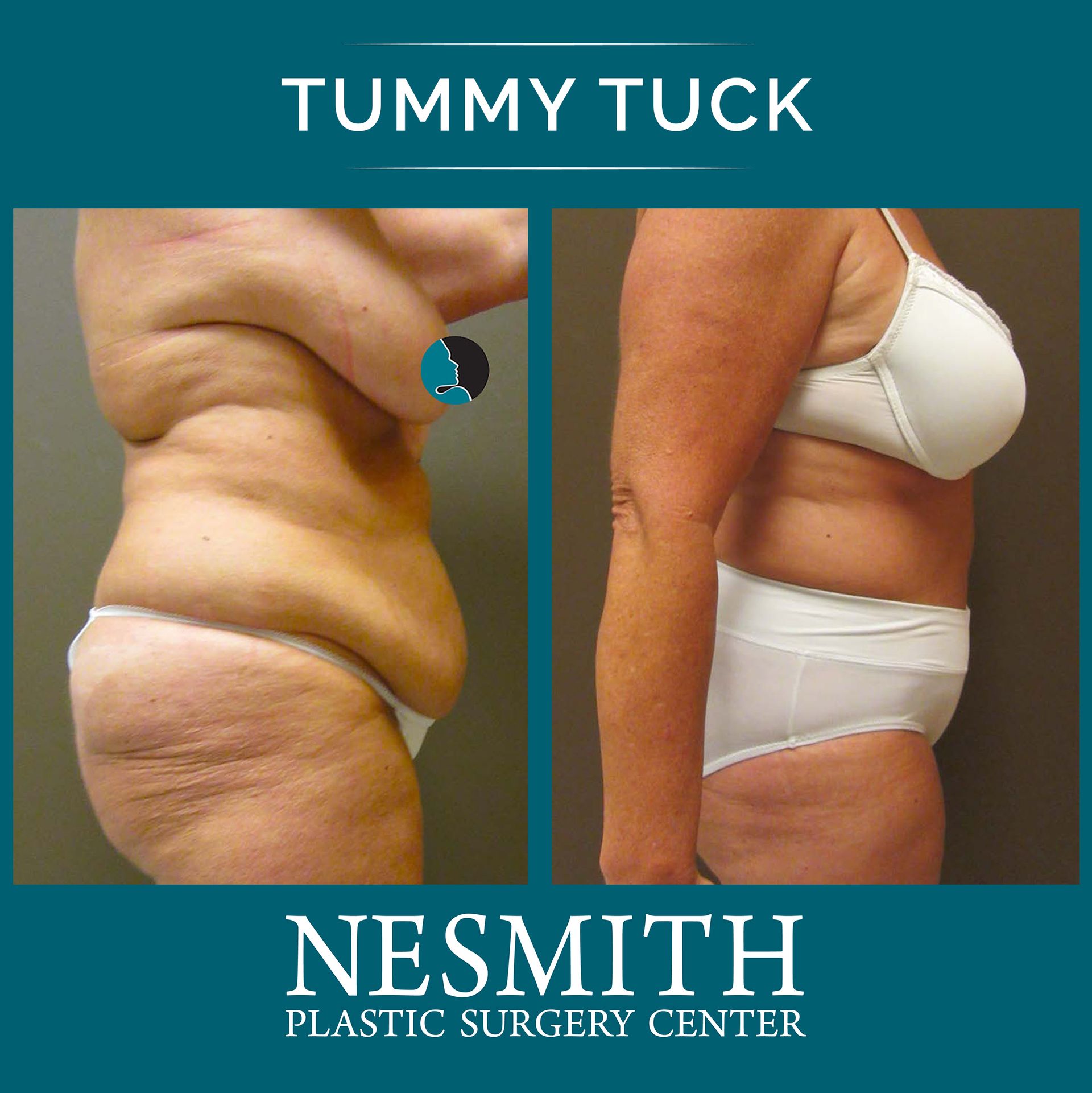 Plastic Surgery Nesmith Plastic Surgery Center Gainesville FL