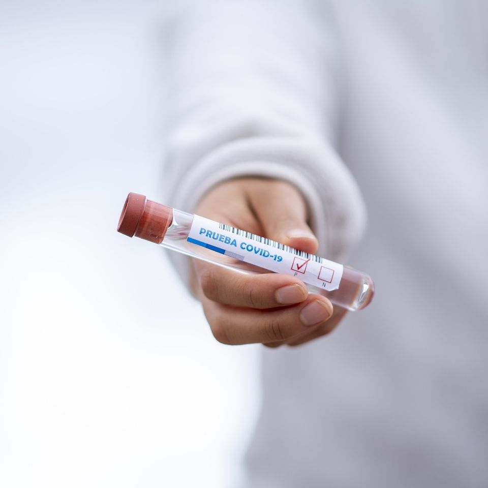 Test tube ge0532e6d1 1920