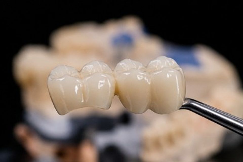 2nd dental pic