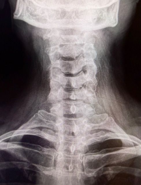 Xray