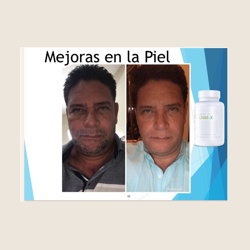Galery activz6