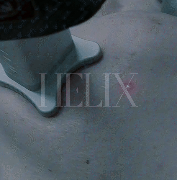 Helix Laser performed by Beauty Bomb Aesthetics