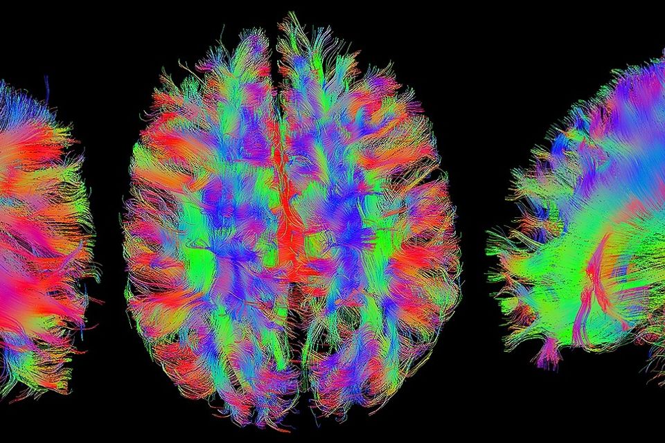 Brain g0f4481457 1920