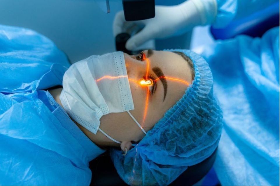 Lasik surgery