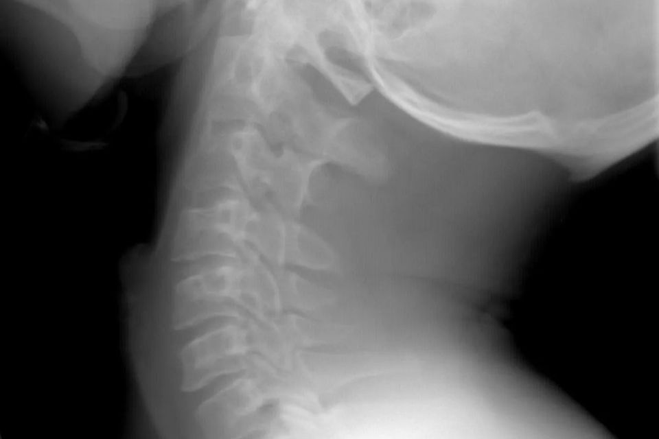 Chiropractic xray for chiropractic care
