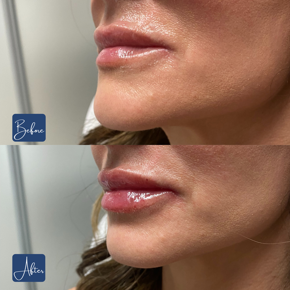 Lips 16