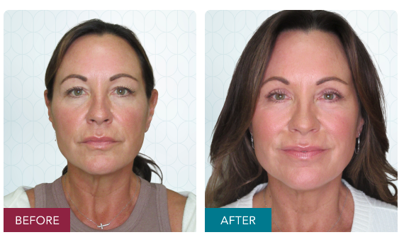 Screenshot 2026 03 23 at 3.37.49 pm