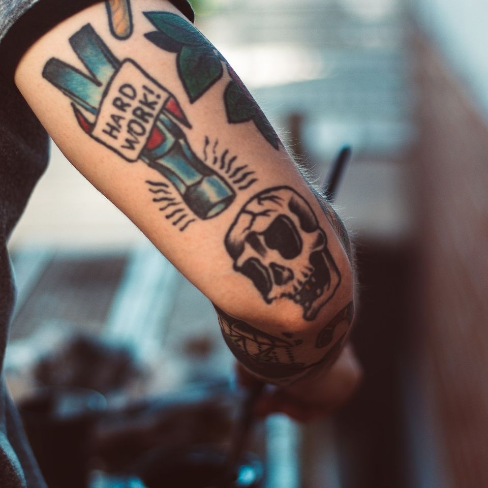 Laser Tattoo Removal