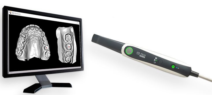 Carestream cs scanner