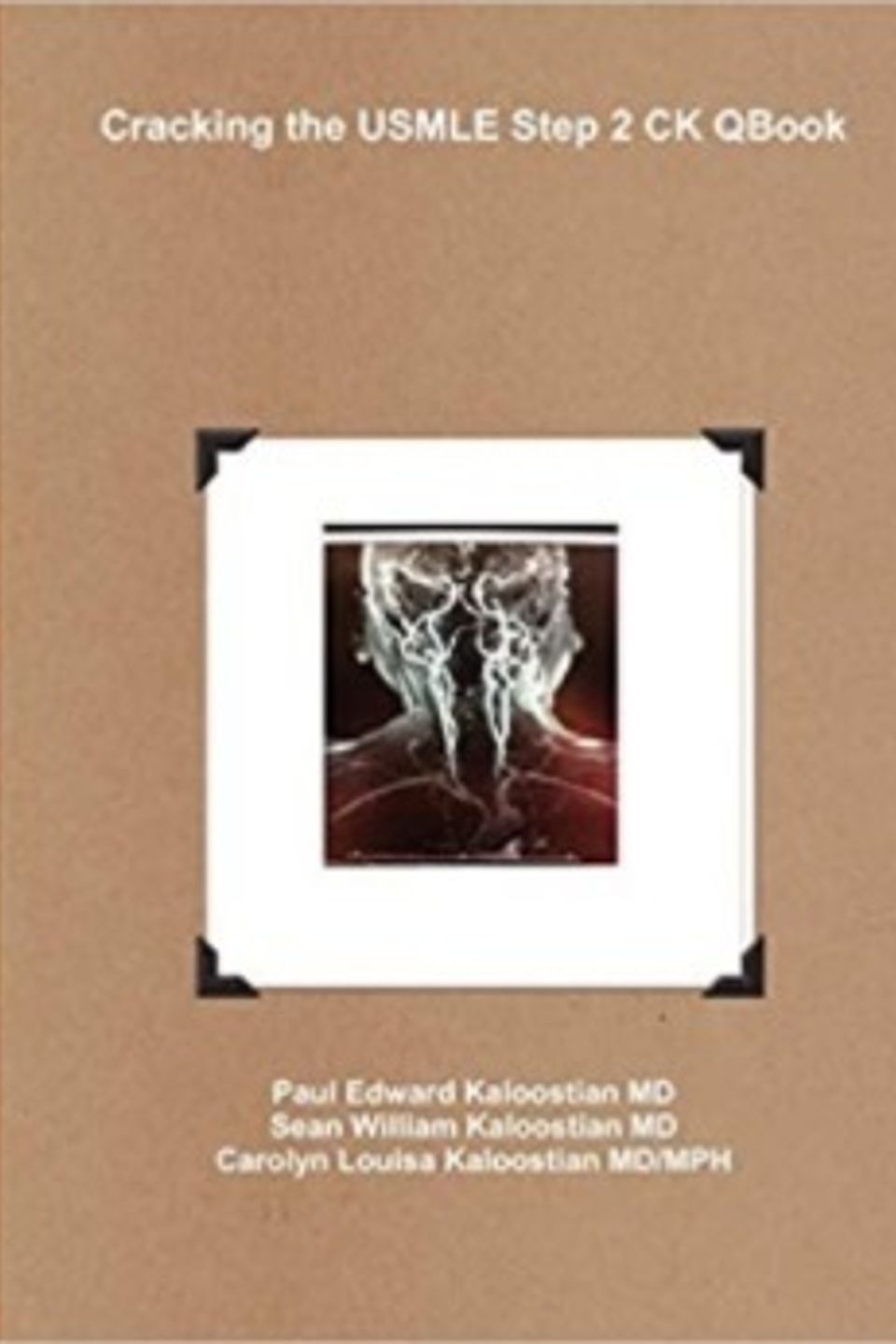 Cracking the usmle step 2 ck qbook
